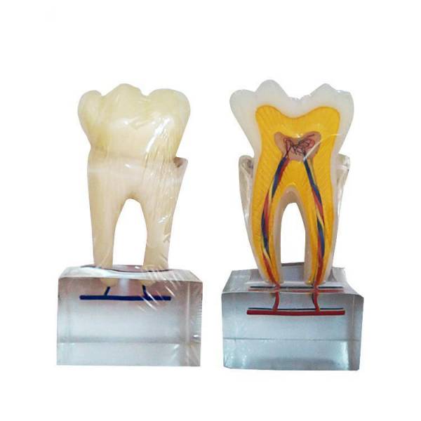 UM-U14 sechsmal normales Zahn anatomie modell