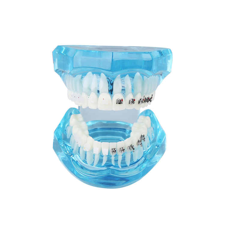UM-B21 transparente Zahnmedizin mit Klammern